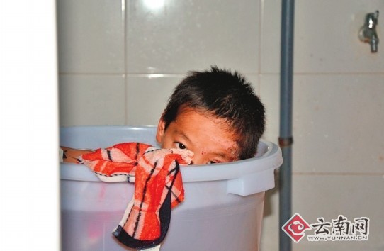 楚雄9岁男孩被严重烧伤 每次换药都是一次撕心